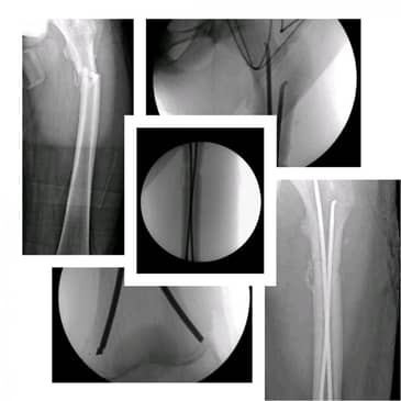 Slider image (4) Dr. Rodrigo Aguirre Rojas Orthopedic Surgeon